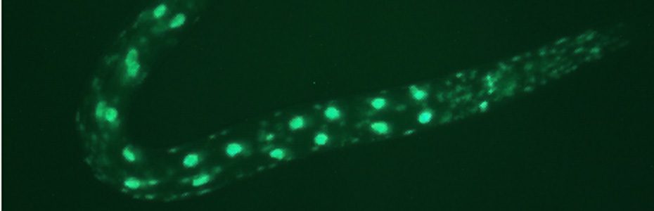 C. elegans cell signaling in the Savage-Dunn Lab. C. elegans cell signaling in the Savage-Dunn Lab.